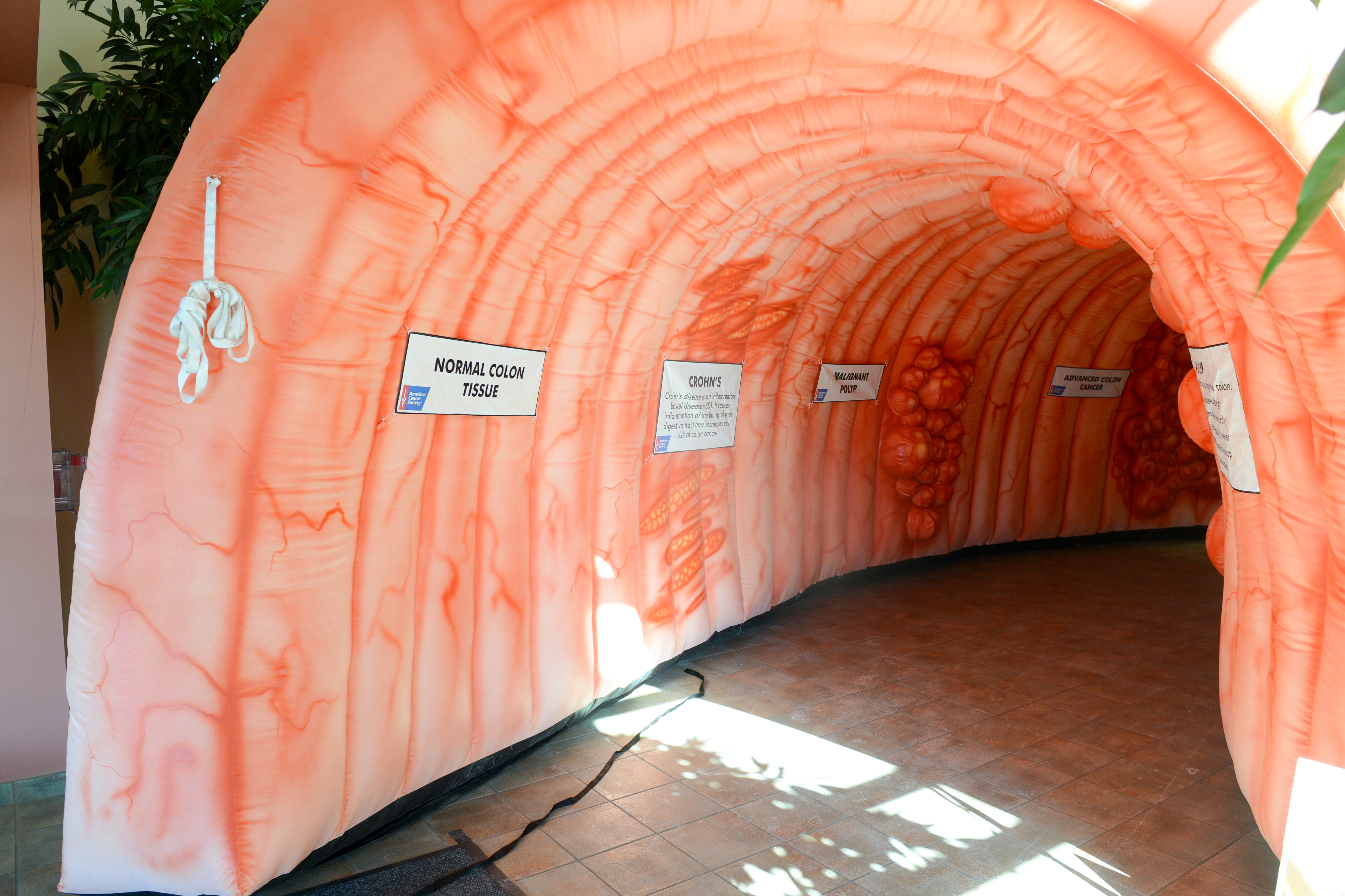 Large inflatable colon