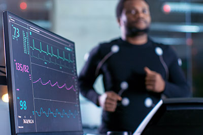 cardiac stress test