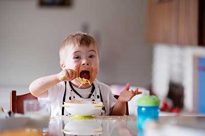 eating challenges down syndrome