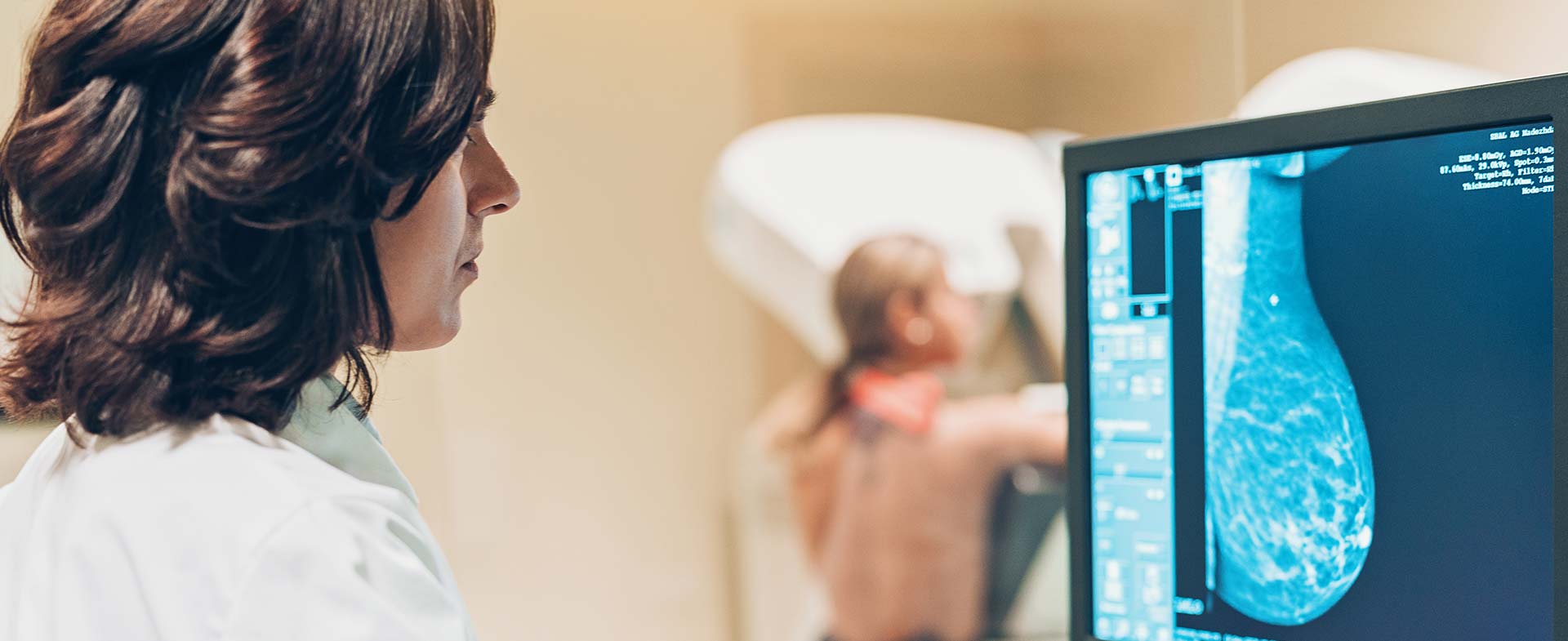 breast cancer screening