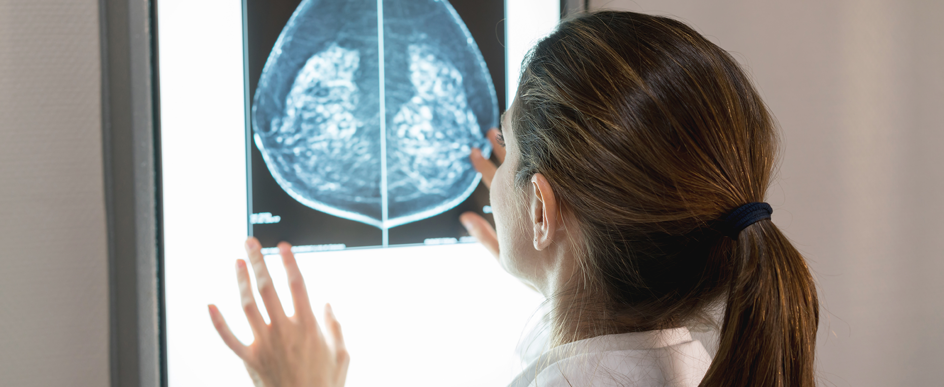 dense breasts on mammogram