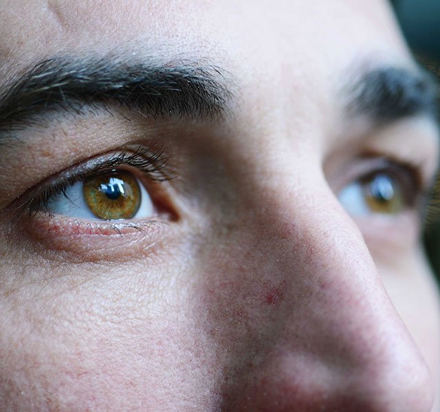 man with eye floaters