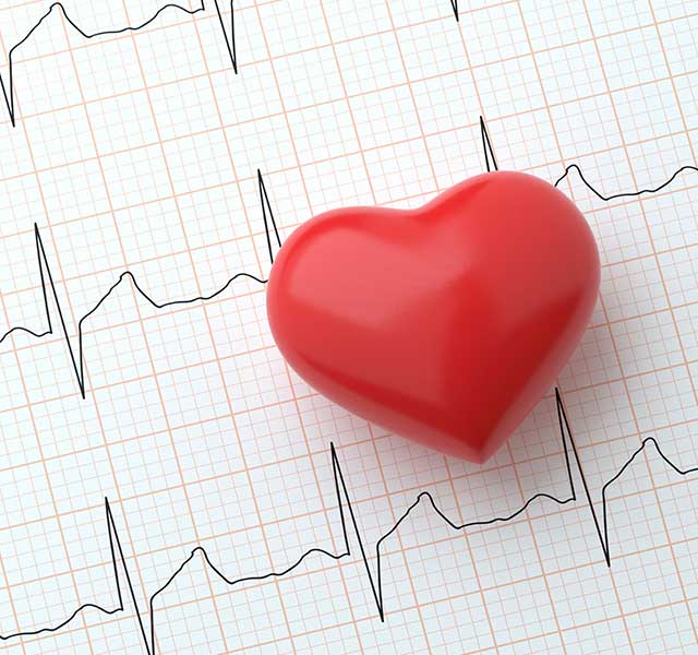 do I have AFib symptoms