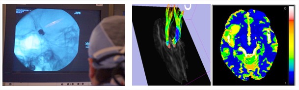 Vascular Neuro Image