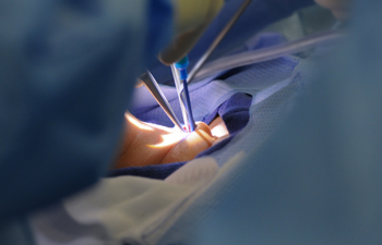 minimally invasive thyroidectomy